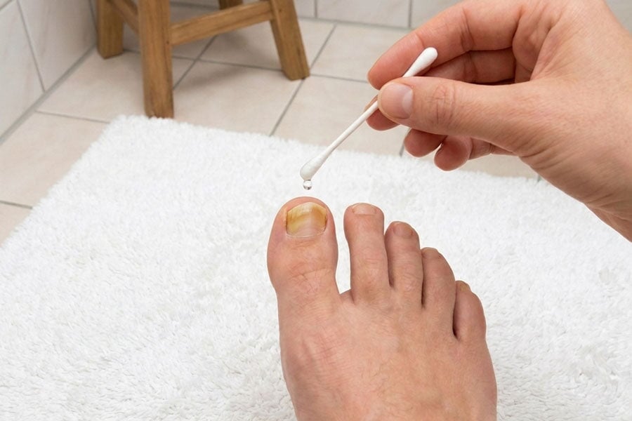 Gelbe Nägel: 5 Ursachen und was wirklich hilft