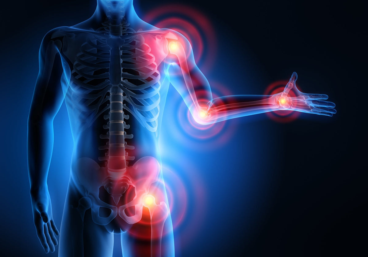 Was ist Arthrose ?