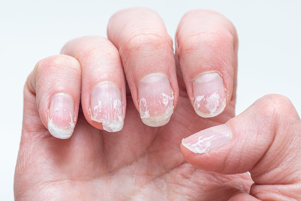 Die Bedeutung der Nagelmatrix: Wachstum und Formgebung